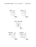 Sensor Arrangement for Sensing Rotation Angles on a Rotating Component in     a Vehicle diagram and image