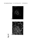 METHOD FOR OBSERVING STEM CELLS, METHOD FOR REMOVAL OF CELL REGION IN     STATE TENDING TOWARD DIFFERENTIATION, AND DEVICE FOR OBSERVING STEM CELLS diagram and image