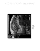 METHOD AND SYSTEM OF ASSESSING OR ANALYZING MUSCLE CHARACTERISTICS     INCLUDING STRENGTH AND TENDERNESS USING ULTRASOUND diagram and image