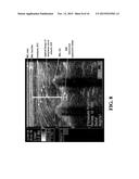 METHOD AND SYSTEM OF ASSESSING OR ANALYZING MUSCLE CHARACTERISTICS     INCLUDING STRENGTH AND TENDERNESS USING ULTRASOUND diagram and image