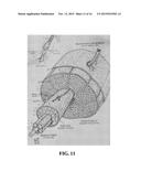 METHOD AND SYSTEM OF ASSESSING OR ANALYZING MUSCLE CHARACTERISTICS     INCLUDING STRENGTH AND TENDERNESS USING ULTRASOUND diagram and image