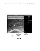 METHOD AND SYSTEM OF ASSESSING OR ANALYZING MUSCLE CHARACTERISTICS     INCLUDING STRENGTH AND TENDERNESS USING ULTRASOUND diagram and image