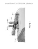 HEAD-UP DISPLAY WITH EYE-TRACKER FOR MRI APPLICATIONS diagram and image