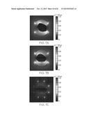 PARALLEL PLATE TRANSMISSION LINE FOR BROADBAND NUCLEAR MAGNETIC RESONANCE     IMAGING diagram and image