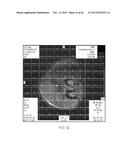 PARALLEL PLATE TRANSMISSION LINE FOR BROADBAND NUCLEAR MAGNETIC RESONANCE     IMAGING diagram and image