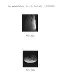 PARALLEL PLATE TRANSMISSION LINE FOR BROADBAND NUCLEAR MAGNETIC RESONANCE     IMAGING diagram and image