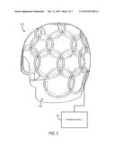 SYSTEM AND METHOD FOR IMPROVED RADIO-FREQUENCY DETECTION OR B0 FIELD     SHIMMING IN MAGNETIC RESONANCE IMAGING diagram and image