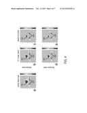 SYSTEM AND METHOD FOR IMPROVED RADIO-FREQUENCY DETECTION OR B0 FIELD     SHIMMING IN MAGNETIC RESONANCE IMAGING diagram and image