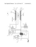 Methods, Systems and Apparatuses for Rapid Segmented, Accelerated, and     Simultaneous Multi-Slice Echo Planar Imaging diagram and image