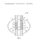 NUCLEAR MAGNETIC RESONANCE REFOCUSING PULSES FOR INHOMOGENEOUS MAGNETIC     FIELDS diagram and image