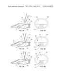 ENHANCED USER INTERFACE FOR A WEARABLE ELECTRONIC DEVICE diagram and image