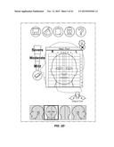 PAIN SURVEYING AND VISUALIZATION IN A HUMAN BODILY REGION diagram and image