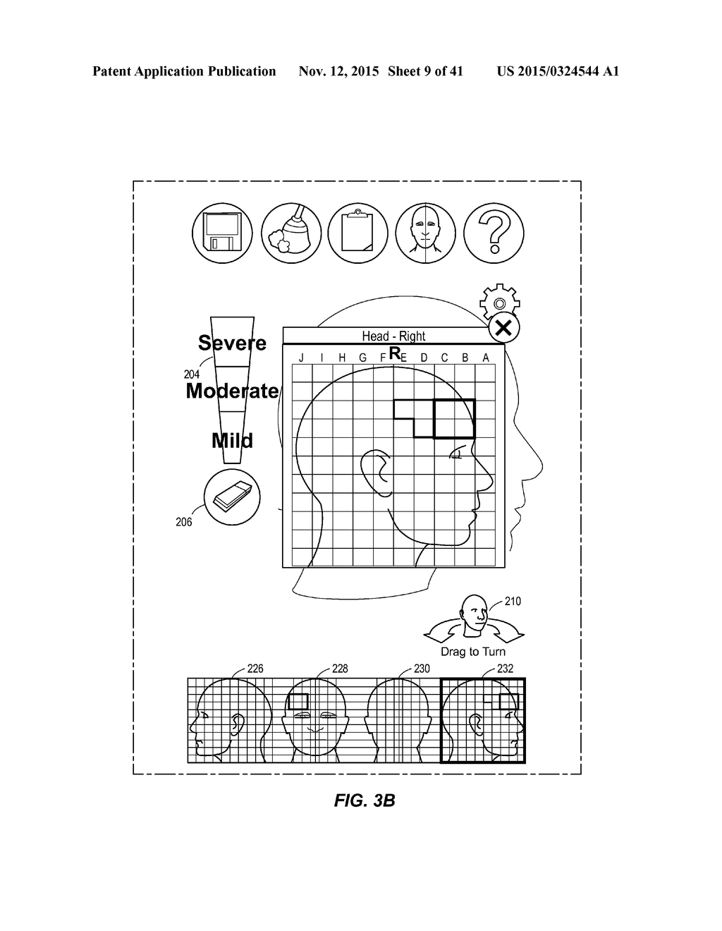 PAIN SURVEYING AND VISUALIZATION IN A HUMAN BODILY REGION - diagram, schematic, and image 10