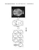 PAIN SURVEYING AND VISUALIZATION IN A HUMAN BODILY REGION diagram and image