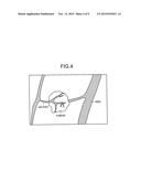 X-RAY DIAGNOSTIC APPARATUS diagram and image