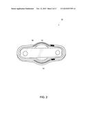 APPARATUS FOR SECURING AN ELECTRONIC COMPONENT diagram and image