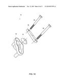 APPARATUS FOR SECURING AN ELECTRONIC COMPONENT diagram and image