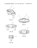 APPARATUS FOR SECURING AN ELECTRONIC COMPONENT diagram and image