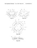 Attachment Device diagram and image