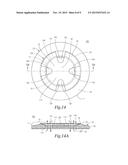 Attachment Device diagram and image