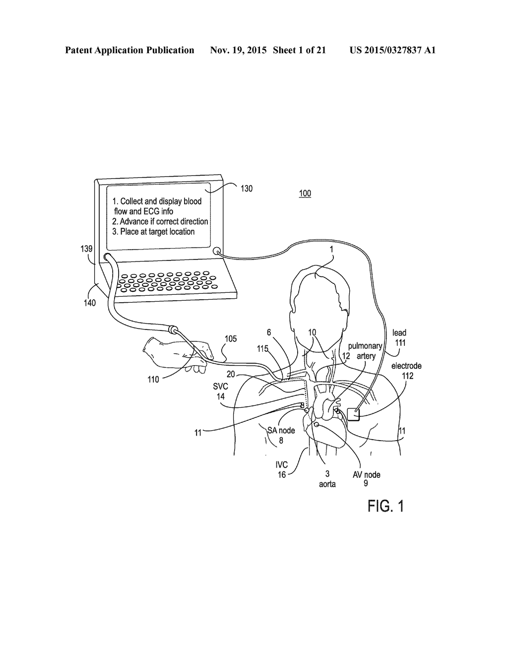 ENDOVASCULAR NAVIGATION SYSTEM AND METHOD - diagram, schematic, and image 02