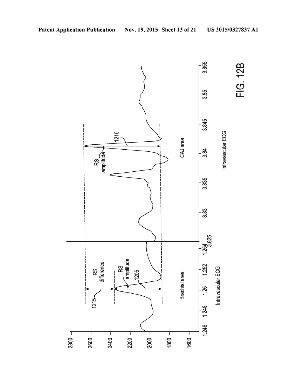 ENDOVASCULAR NAVIGATION SYSTEM AND METHOD - diagram, schematic, and image 14