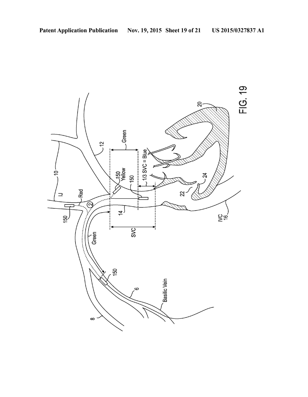 ENDOVASCULAR NAVIGATION SYSTEM AND METHOD - diagram, schematic, and image 20