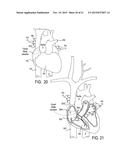 ENDOVASCULAR NAVIGATION SYSTEM AND METHOD diagram and image