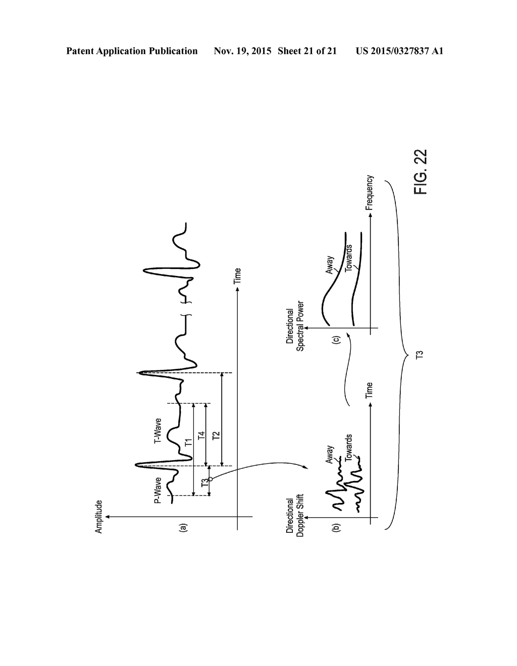 ENDOVASCULAR NAVIGATION SYSTEM AND METHOD - diagram, schematic, and image 22