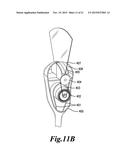 TRACKING IN ULTRASOUND FOR IMAGING AND USER INTERFACE diagram and image