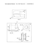 SELF-CLOSING DEVICES AND METHODS FOR MAKING AND USING THEM diagram and image