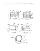 SELF-CLOSING DEVICES AND METHODS FOR MAKING AND USING THEM diagram and image