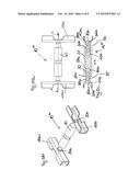 Sternum Spreader diagram and image