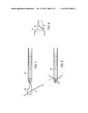 SUTURE ANCHOR EYELET WITH SUTURE LOADER diagram and image