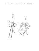 SUTURE ANCHOR EYELET WITH SUTURE LOADER diagram and image