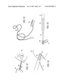 SUTURE ANCHOR EYELET WITH SUTURE LOADER diagram and image