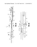 Surgical Instrument diagram and image