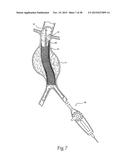 Surgical Fastener Assembly for Attaching a Prosthesis diagram and image