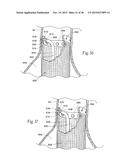 Surgical Fastener Assembly for Attaching a Prosthesis diagram and image