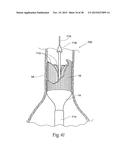 Surgical Fastener Assembly for Attaching a Prosthesis diagram and image