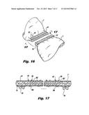 DETACHABLE BUTTRESS MATERIAL RETENTION SYSTEMS FOR USE WITH A SURGICAL     STAPLING DEVICE diagram and image