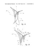 DEVICES, SYSTEMS AND METHODS FOR ENCLOSING AN ANATOMICAL OPENING diagram and image