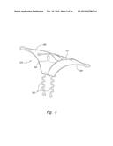 DEVICES, SYSTEMS AND METHODS FOR ENCLOSING AN ANATOMICAL OPENING diagram and image