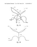 DEVICES, SYSTEMS AND METHODS FOR ENCLOSING AN ANATOMICAL OPENING diagram and image