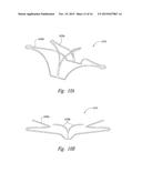 DEVICES, SYSTEMS AND METHODS FOR ENCLOSING AN ANATOMICAL OPENING diagram and image