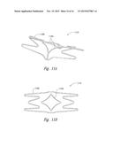 DEVICES, SYSTEMS AND METHODS FOR ENCLOSING AN ANATOMICAL OPENING diagram and image