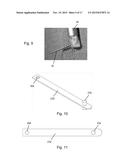 METHOD OF PERFORMING SACROILIAC FUSION diagram and image