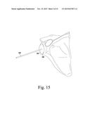 OSCILLATING RASP FOR USE IN AN ORTHOPAEDIC SURGICAL PROCEDURE diagram and image
