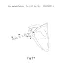 OSCILLATING RASP FOR USE IN AN ORTHOPAEDIC SURGICAL PROCEDURE diagram and image