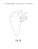 OSCILLATING RASP FOR USE IN AN ORTHOPAEDIC SURGICAL PROCEDURE diagram and image